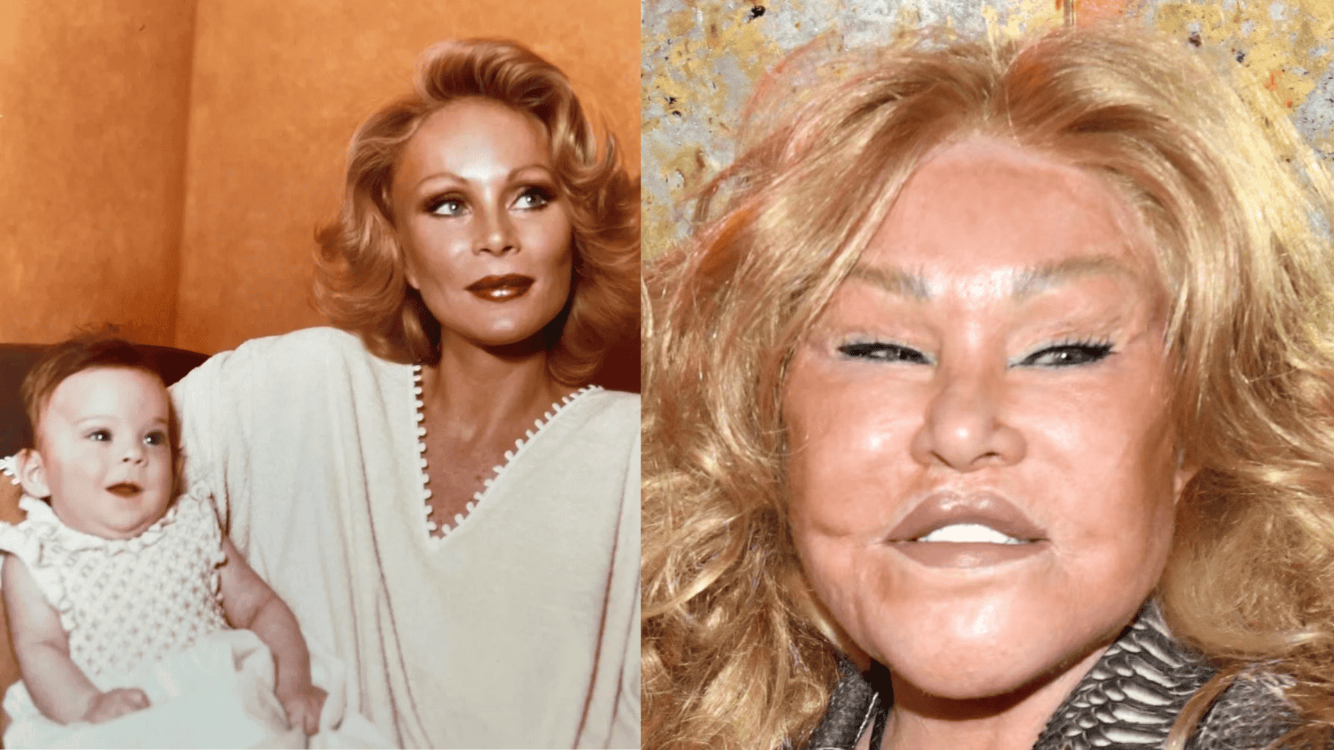 Jocelyn Wildenstein surgeries